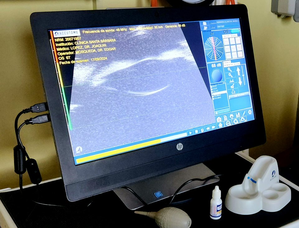 Cirugía de retina
